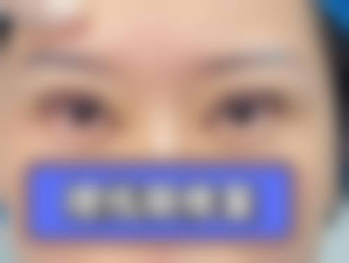 深圳人民医院整形科预约留手机号后多久能收到回复?真实患者经历分享