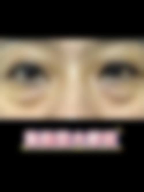 眼袋怎么预防热敷还是冰敷好？掌握热敷促进循环、冰敷缓解水肿方法，超有效！ 