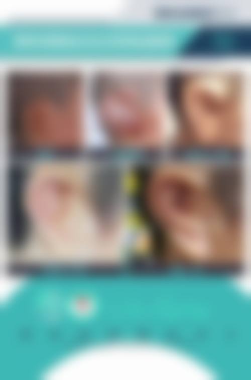 武汉外耳再造术全国排名，排名靠前医院与专家解析