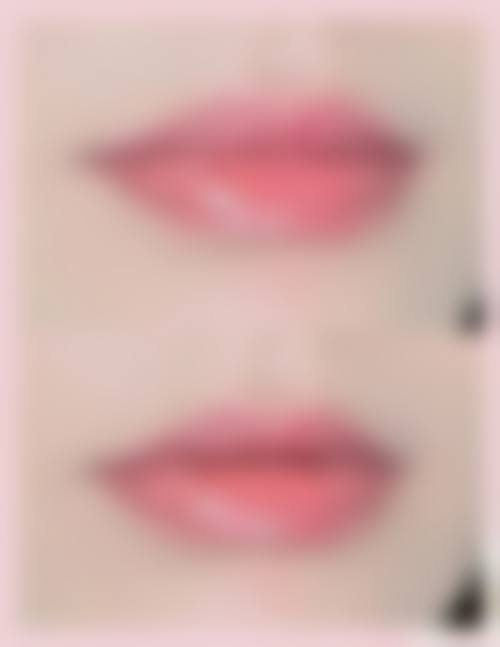 深圳玻尿酸丰唇哪个医院好