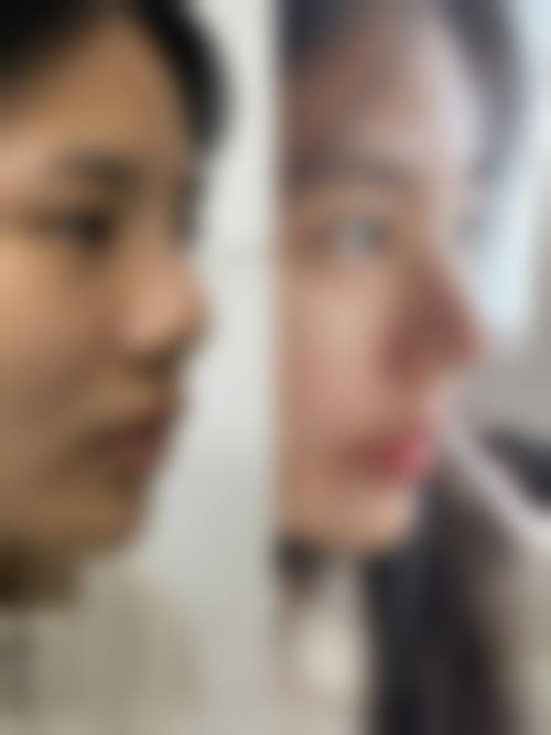 深圳人民医院整形外科价目表2024全新版:热门项目收费明细