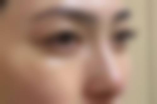 成都乔雅登玻尿酸正品价格是多少一支？收费标准揭秘，价格不贵超靠谱！ 