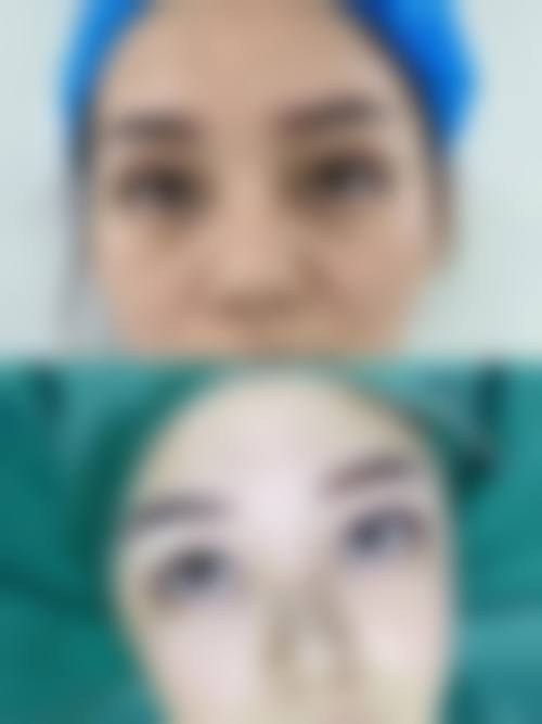 连天美口碑好在哪？从技术到服务，这3点让求美者放心！