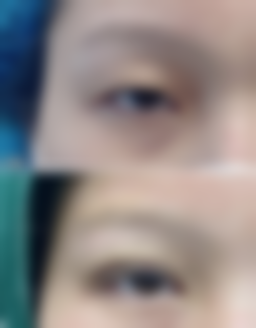 技术核心与医生团队：杭州天鑫哪些项目和技术真正靠得住？