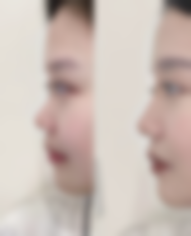 深圳富华医美医院价格贵不贵？