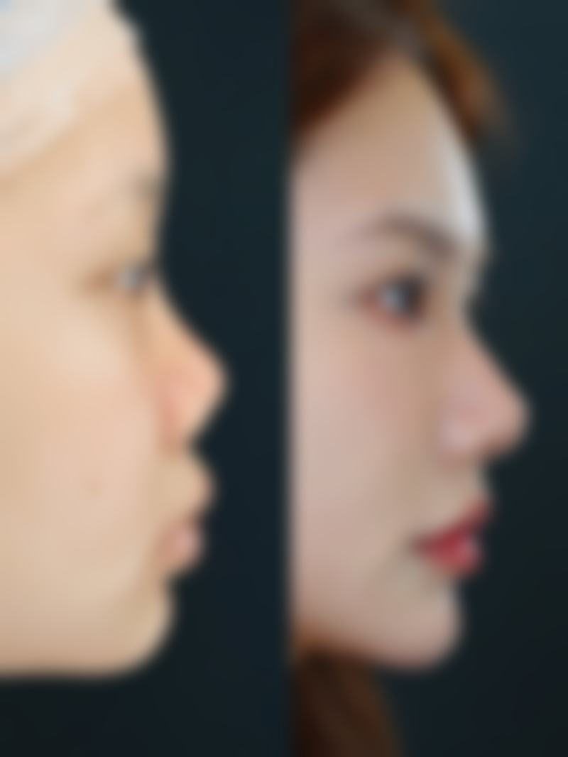 适合人群与终极避坑指南：对号入座，一次选对！