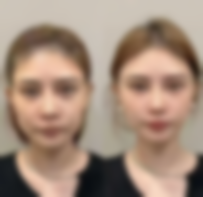 八、延伸对比：沈阳还有哪些值得了解的医美选择？