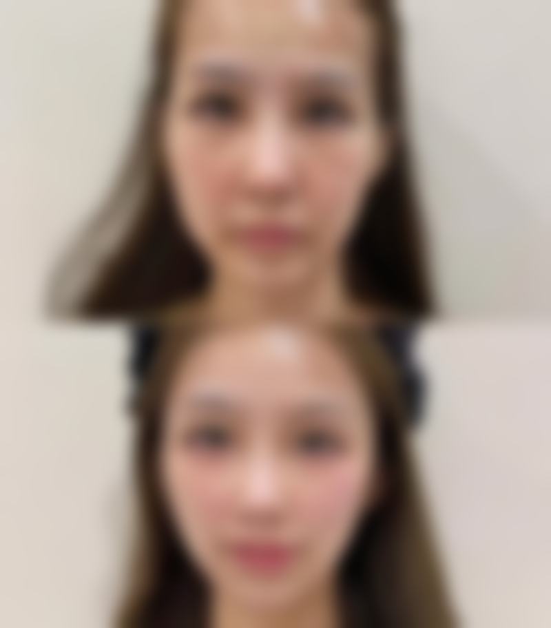 探店实感：杭州天鑫医美的环境与初体验服务能打几分？