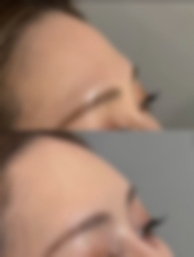 三仁医美电话询问:能问哪些问题?医生在线解答!