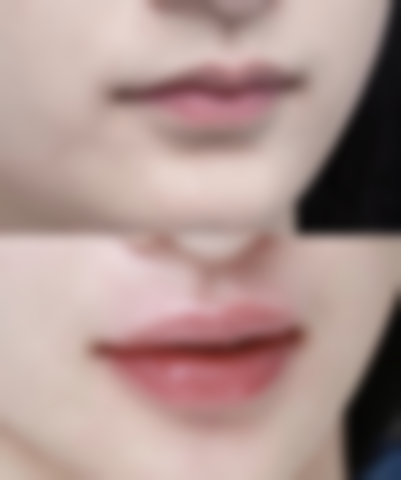 深圳注射丰唇哪家医院靠谱？这几家正规医美机构值得一看