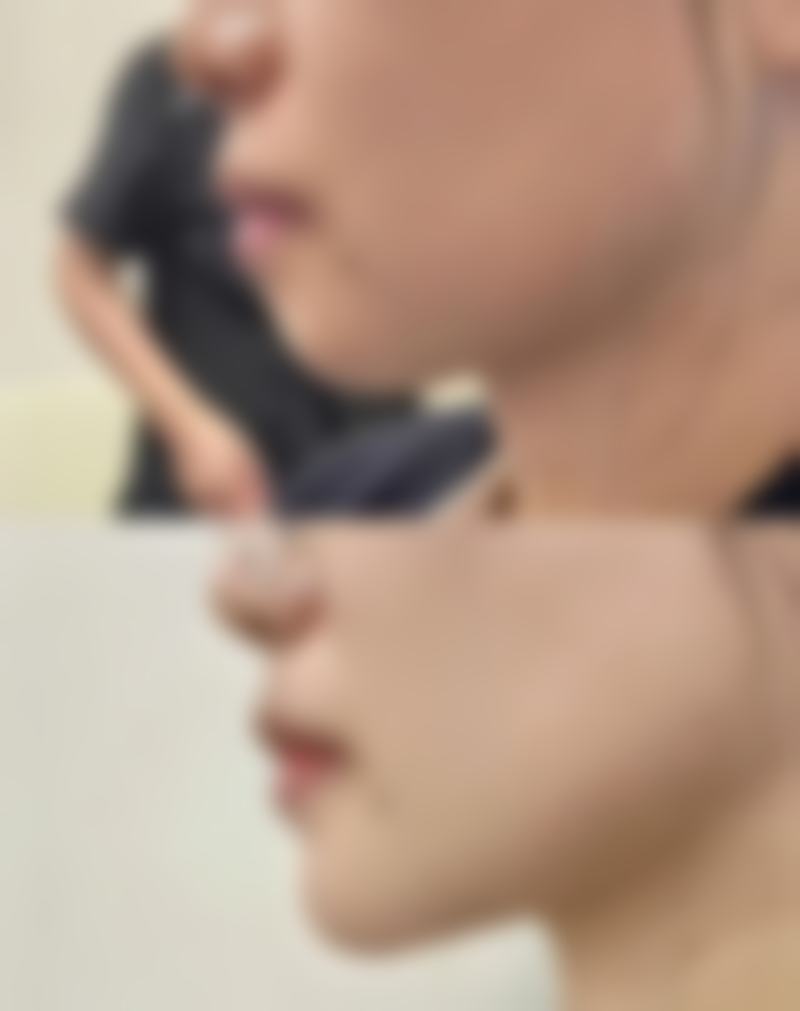 五、去黑龙江省医院整形美容科,哪些项目值得做?