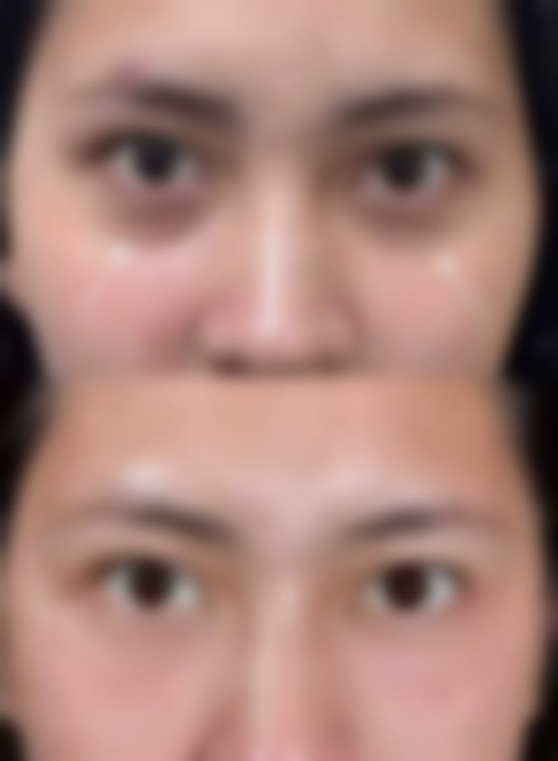 深圳人民医院整形科主事是谁?具有影响力骨干医生团队实力如何