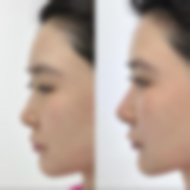 八、价格贵不贵?黑龙江省医院整形美容科收费揭秘