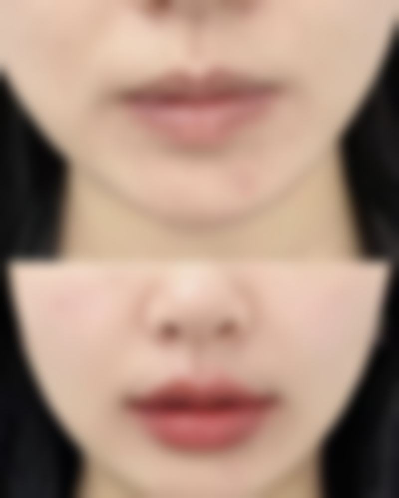 关于“上海华美医院”和“上海华美电梯装饰有限公司”，它们和上海华美医疗美容医院有关系吗？