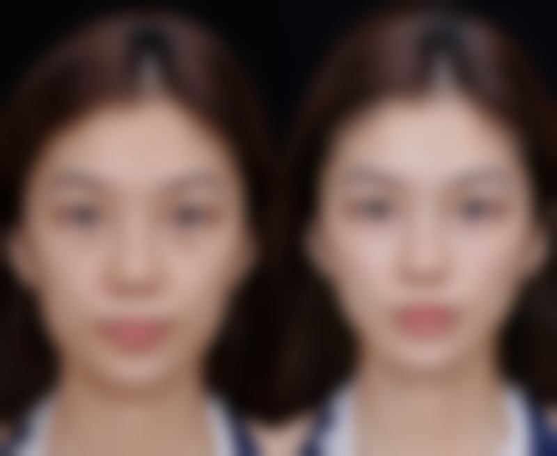 二、“候补挂号”到底有多智能?告别蹲点刷号的痛苦!