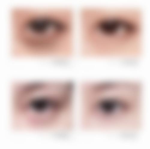 四、郑金满医生技术优势与操作流程