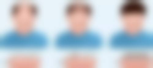 第六名：武警河南总队医院——安心有保护的吸脂医院