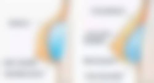 佛山私密整形医院怎么选？牢记这3点不踩坑