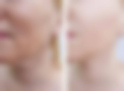 郑州紧缩针的价格情况