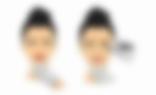 李建钢无痕筋膜提升多少钱