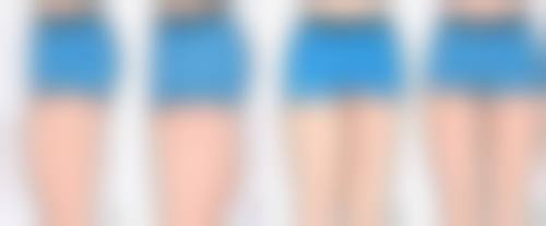 技术价格差异对成都乳房再造手术的影响