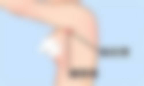 卢元刚医生介绍