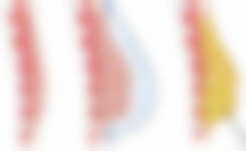 佛山私密整形手术那家好？三家医院核心项目PK