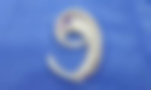 苏州义耳哪里做的最好？苏大附一院、市立医院整形科，专家详解外耳再造更优选