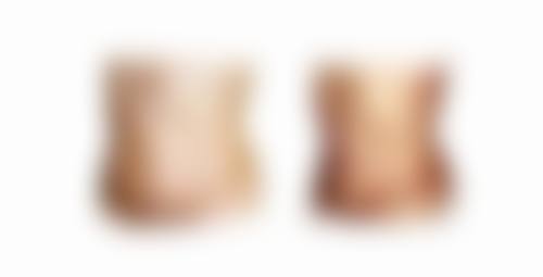 武汉生发针多少钱一针，2026年参考价500元起，武汉一医院生发醑用法详解