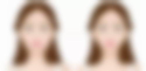 沈阳哪个医院有阴茎入珠术？沈河男科、铁西生殖、和平整形医院可做，还有专业手艺人服务