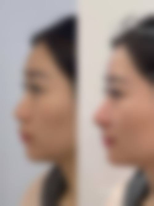 真实实例见证:自然又惊艳的医美成效