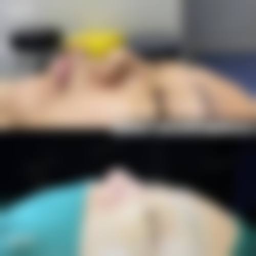 韩国优雅人整形外科医院还有哪些擅长项目?