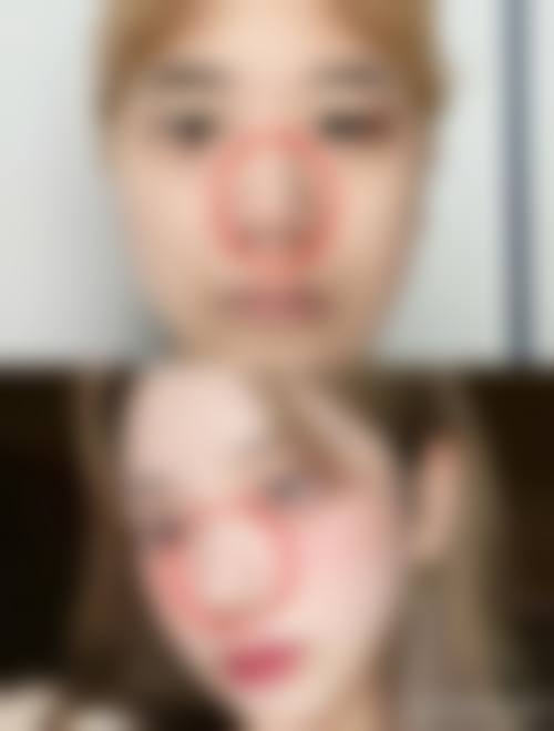 杭州天鑫医疗美容医院专精团队是如何打造自然美的？