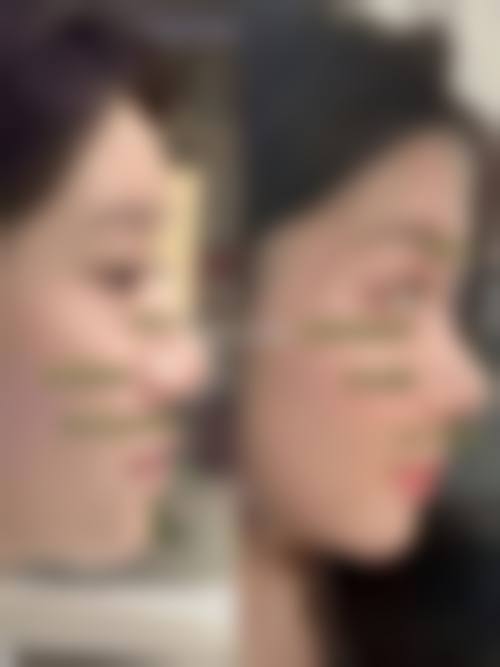 深圳艺星整形医院地址在哪里？