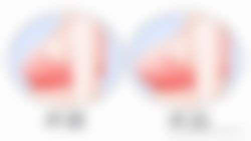 杭州连天美医疗美容医院手术成效如何?