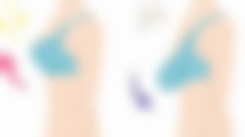 假体材质与品牌:进口与国产的价格鸿沟