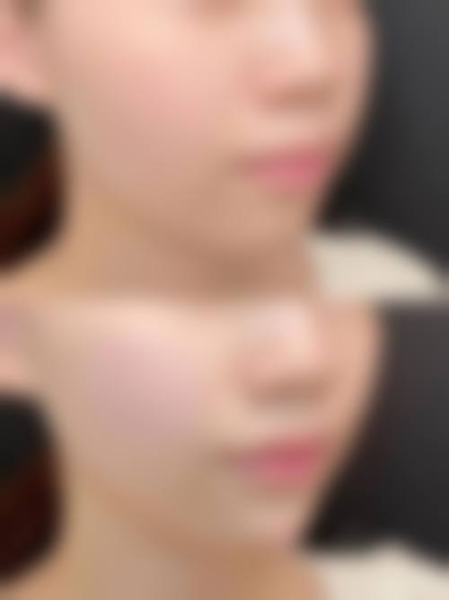 八、去佛山市二医美容科前，还有哪些必须了解的避坑细节？