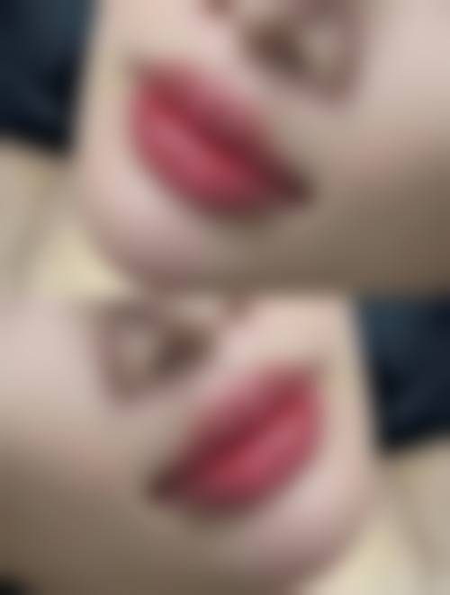 武汉诠美医疗美容门诊部——厚唇改薄精致体验