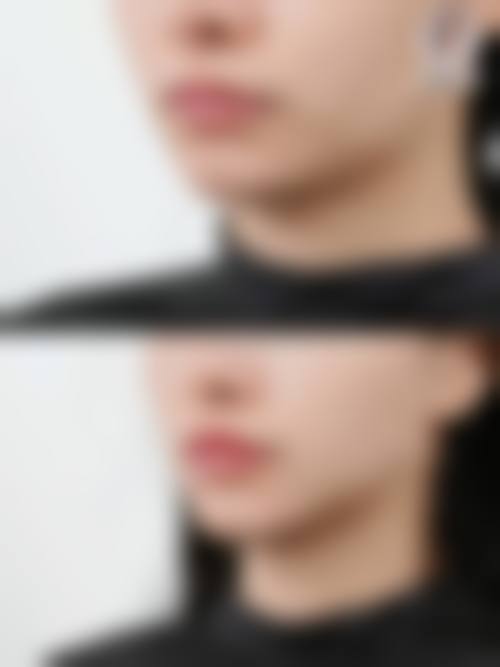 武汉欣美荟医疗美容门诊部——厚唇改薄前列之选