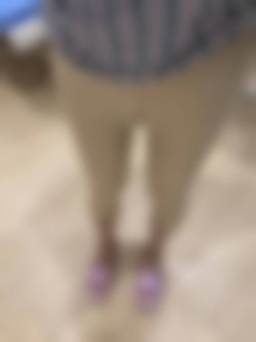 {大腿吸脂坏死怎么办？找正规医院清创植皮修复，可申请医疗事故鉴定