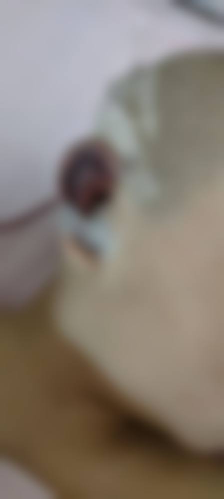 沈阳招风耳整形不同术式价格差异