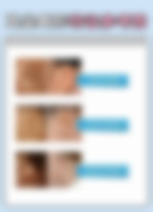 四、手术相关关键问题全解答