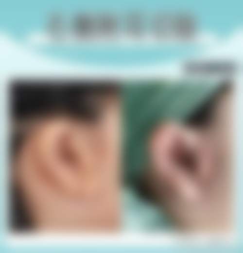 沈阳国有医院招风耳整形价格明细
