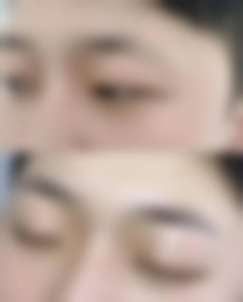 北京脱发治疗比较好的医院有哪些优势？