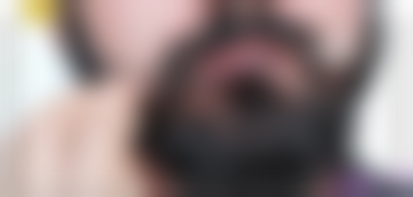 北京看脱发医院的价格如何？