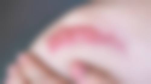 不是疤痕体质疤痕会慢慢消除吗？答案是肯定的，非疤痕体质疤痕消除知识全解析！ 