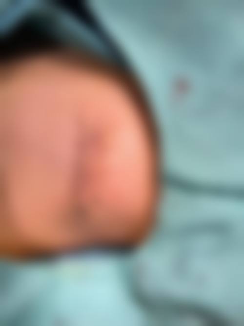 从医学角度看，擦伤疤痕怎么去除用什么药膏的风险主要集中在哪些环节