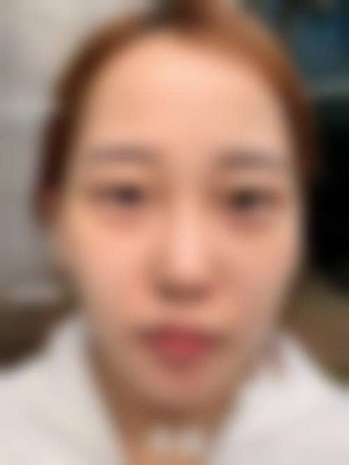 五、第一次去佛山市二医美容科，门诊时间和流程是怎样的？