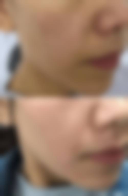 杭州医院激光祛斑多少钱一次？价格受设备和斑种影响，收费标准靠谱吗？2026年参考：艺星双核光祛斑、树兰激光美容项目价格解析