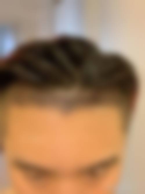 七、谁更适合去杭州连天美做半肋鼻?快来对号入座!